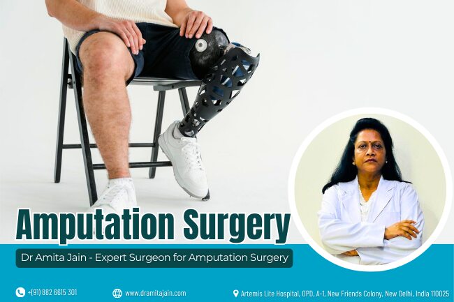 best amputation doctor in India Dr Amita Jain
